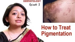 How to Treat Skin Pigmentation Episode 3 [upl. by Aekerly]