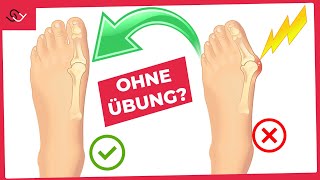 Hallux Valgus und Fußschmerzen los werden  ohne Übung [upl. by Viafore]