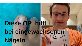 Hilfe bei eingewachsenen Zehenägeln [upl. by Yerfej479]