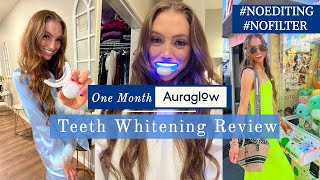 Auraglow LED Teeth Whitening Kit Unboxing amp 1 Month Review  Habit Stack amp Add to a Daily Routine [upl. by Krever]