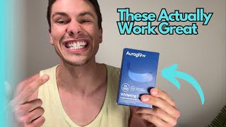 Auraglow Teeth Whitening Strips Review [upl. by Streeter]