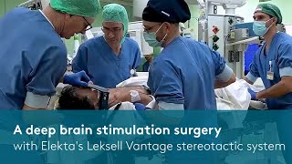 A DBS surgery with Elektas Leksell Vantage stereotactic system [upl. by Chapland]