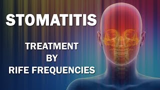 Stomatitis  RIFE Frequencies Treatment  Energy amp Quantum Medicine with Bioresonance [upl. by Frasch]