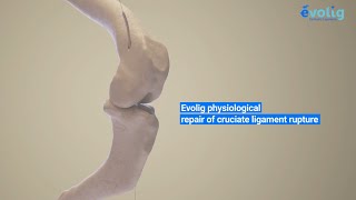 Evolig The Revolution in Veterinary Orthopedics  Cruciate Ligament Surgery Explained [upl. by Giles280]