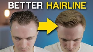 5 POWERFUL Receding Hairline Tricks To INSTANTLY Improve Your Look [upl. by Circosta]