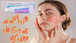 Travogen Cream 1 Used ForFungal Infection Ka IlajIsoconazole Nitrate CreamDr Ijaz Malik [upl. by Eivol]