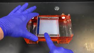 Agarose Gel Electrophoresis [upl. by Jordan]