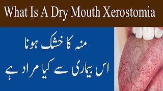 What Is Dry Mouth Xerostomia Condition In Urdu Hindi Muh Khushk Hona Ki Bimari [upl. by Mimi179]