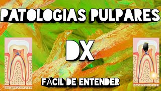 Patologías Pulpares  Diagnóstico Clínico  Pruebas de Vitalidad [upl. by Oaht]