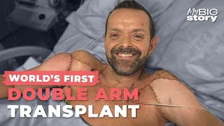 Worlds First Double Arm Transplant Its Science Fiction [upl. by Jamaal]