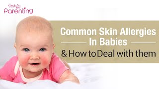 Common Skin Allergies in Babies amp How to Treat Them [upl. by Trenna]