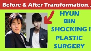 Hyun Bin Plastic Surgery Before and After Full HD [upl. by Adnyc]