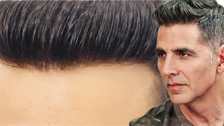 AkshayKumar Hair Patch service for men Delhi Natural lace Hair Wigs Non surgical hair replacement [upl. by Sotsirhc]