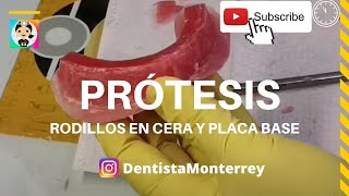 ⏩Placa Base RODETES de Cera 👅 QuickVideo ProtesisDentales ProtesisTotales [upl. by Sivert479]