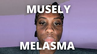 Musely Spot Cream for Melasma Day 1 [upl. by Denoting]