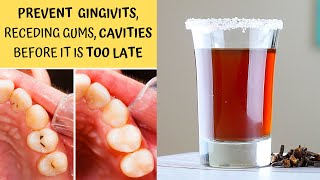 DIY Ayurvedic Mouthwash  Prevents Gingivitis Cavities Tooth Ache amp Gum Diseases [upl. by Saisoj]