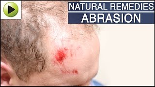 Skin Care  Abrasion  Natural Ayurvedic Home Remedies [upl. by Siuqaj]