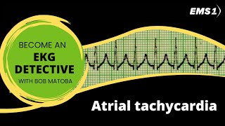 Atrial tachycardia  EKG Detective [upl. by Checani]