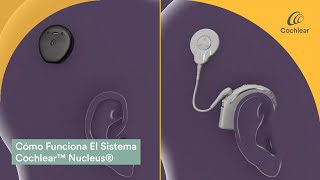 Cómo Funciona El Sistema Cochlear™ Nucleus®  Cochlear Latinoamérica [upl. by Drugi]