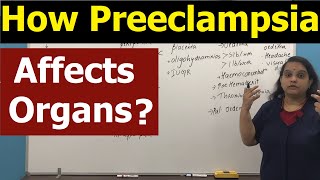 PreEclampsia Part 2 10 FACTS ABOUT PREGNANCY YOUR OBGYN WANTS YOU TO KNOW [upl. by Aja78]