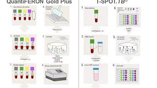 Interferon Gamma Release Assays IGRAs [upl. by Nnylecoj]