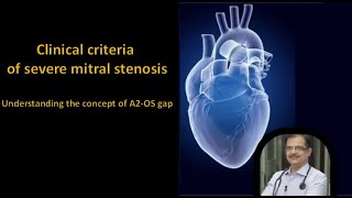 Clinical Criteria of Severe Mitral Stenosis Understanding A2 Opening Snap Gap amp Murmur Length [upl. by Evatsug848]