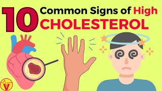 10 Common Signs of High CHOLESTEROL You SHOULD NOT Ignore  VisitJoy [upl. by Ecnarretal]