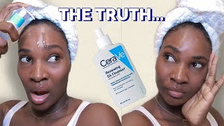 I TRIED CERAVE RENEWING SA CLEANSER FOR 2 WEEKS  HONEST REVIEW [upl. by Yeniffit]