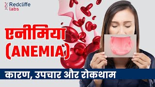 Anemia Symptoms Causes And Treatment In Hindi  शरीर में खून की कमी यानी Anemia कितना ख़तरनाक है [upl. by Binah669]