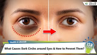 What Causes Dark Circles around Eyes amp How to Prevent Them  ISH News [upl. by Kriste]