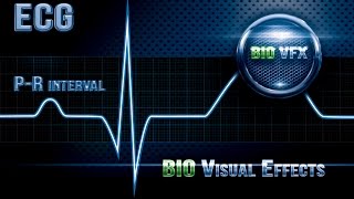 ECG or EKG PR interval part 3 [upl. by Assyl]