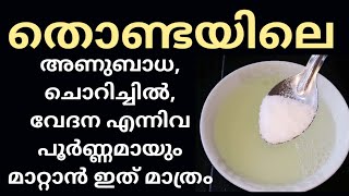 തൊണ്ടയിൽ ഉണ്ടാകുന്ന അണുബാധ തൊണ്ടയിലെ മറ്റു അനുബദ്ധ അസുഖങ്ങൾക്ക് ഇത് മാത്രം മതി  Throat Infection [upl. by Orofselet]