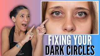 The Surprising Reasons Why You Have Dark Circles Under Your Eyes [upl. by Aticilef]