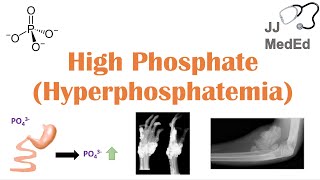 High Phosphate Hyperphosphatemia Dietary Sources Causes Symptoms Treatment [upl. by Amethyst]