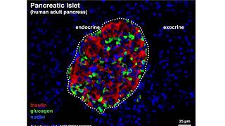 Diabetes mellitus Part 1 [upl. by Drucy551]