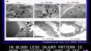 Pathogenesis of Preeclampsia [upl. by Sanson417]