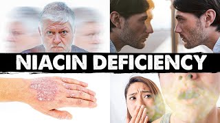 Strange amp Weird Niacin B3 Deficiency Signs and Symptoms [upl. by Kalb]