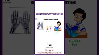 Greulich and Pyle Method shorts dentistry [upl. by Epilihp]