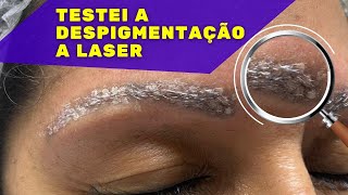 DESPIGMENTAÇÃO DE SOBRANCELHAS A LASER  TESTEI REMOÇÃO DE PIGMENTO A LASER REMOÇÃODETATUAGEM [upl. by Anirb]