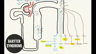 BARTTER SYNDROME and LOOP DIURETICS [upl. by Theresa]