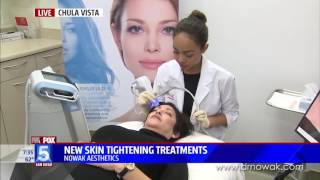 New Skin Tightening Treatment Exilis Ultra Face [upl. by Cointon]