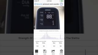 An example when the difference between automated BP and auscultatory BP is big [upl. by Cummings]