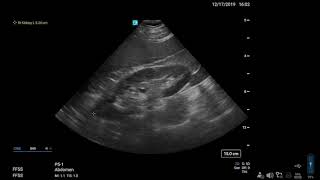 Sonosite PX Help Video  Taking Measurements [upl. by Afinom552]