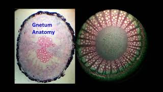 Gnetum Anatomy [upl. by Esorlatsyrc]