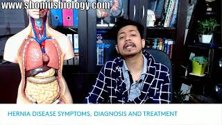 Hernia symptoms test diagnosis and surgery  Hernia kya hota hai Hindi mein [upl. by Hallock]