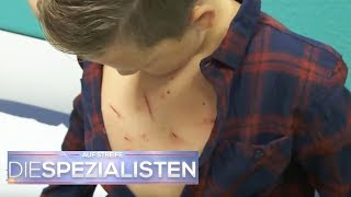 Schnittwunden auf der Brust Hat Felix 8 etwa einen Tumor  Die Spezialisten  SAT1 [upl. by Ofilia]