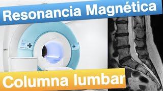 Resonancia magnética Lumbar  Cuándo y cómo se realiza [upl. by Luisa737]