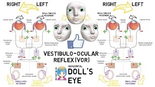 INSTANT NEURO  Dolls Eye [upl. by Nabroc]