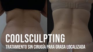 Coolsculpting Tratamiento sin cirugía para la grasa localizada [upl. by Llerol]