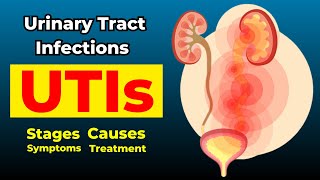 Urinary Tract Infections  Causes Symptoms Treatments and more [upl. by Ybsorc788]